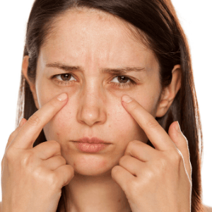 thermage  eye lift